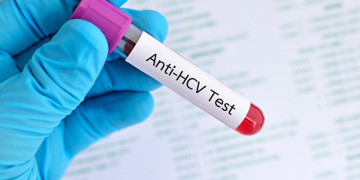 Anti HCV Test During Pregnancy