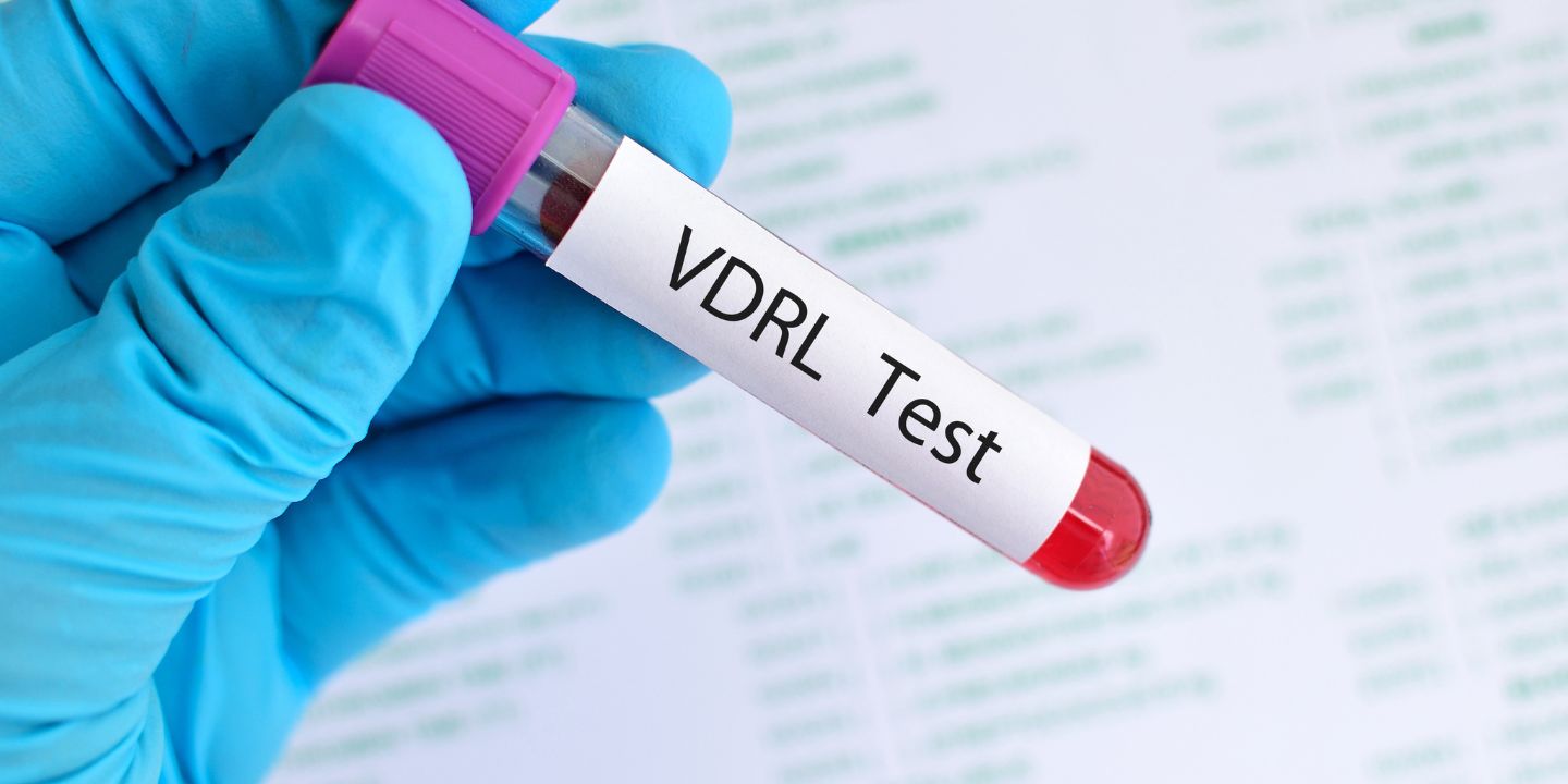 VDRL Test During Pregnancy_ Purpose, Procedure, and Results