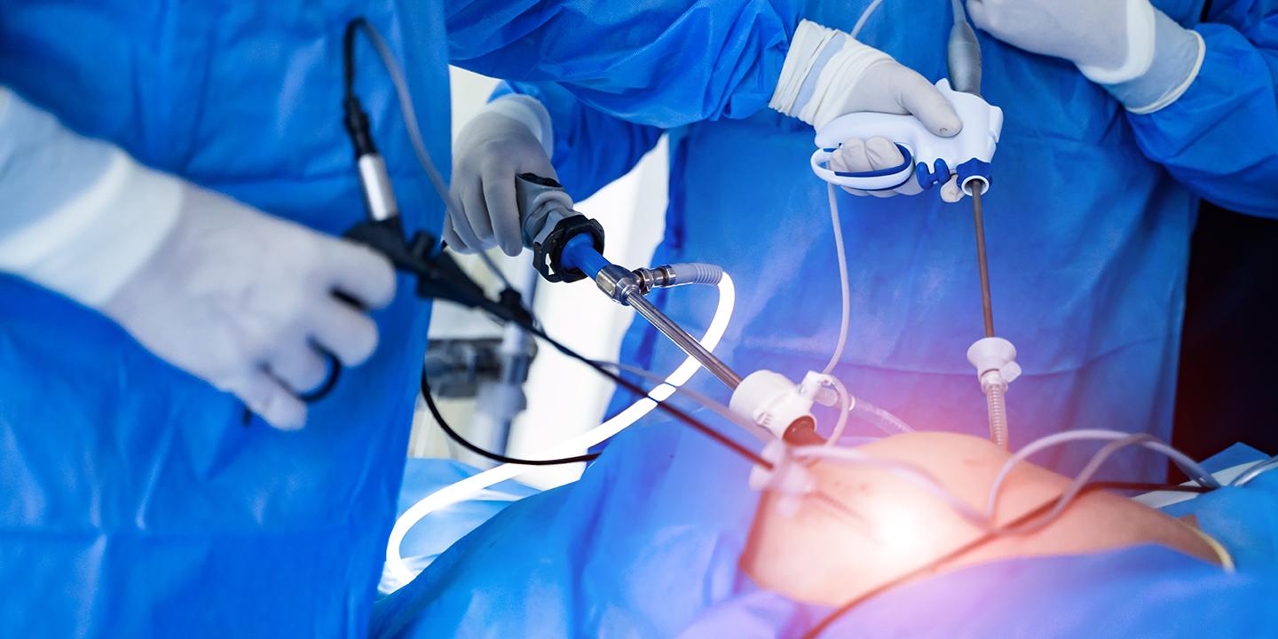 Laparoscopy Vs Hysteroscopy Procedure Which One Is Better